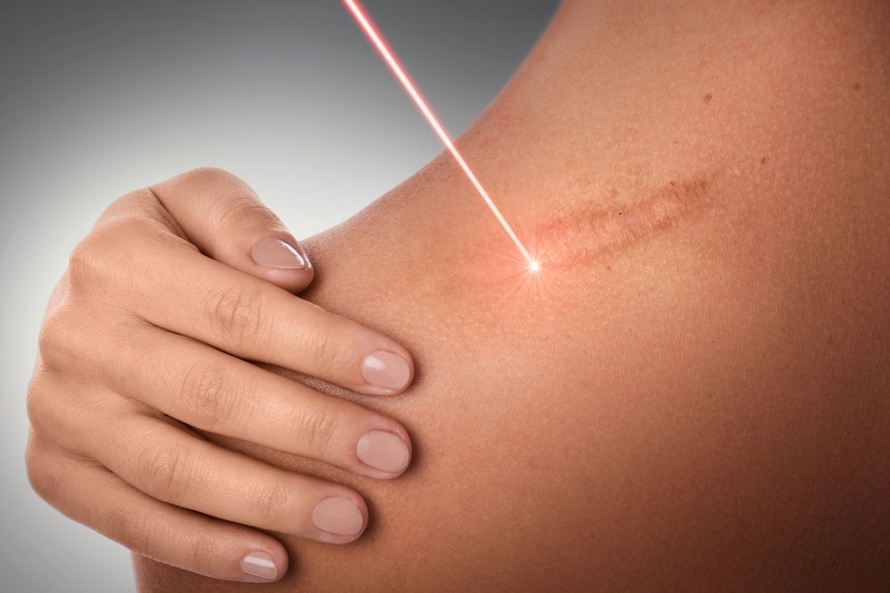 Nowa generacja laserów pikosekundowych